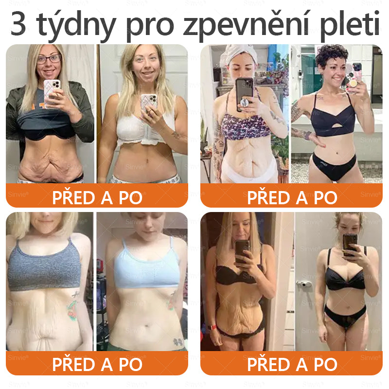 Doporučení dermatologa 🐝 ✨Sinvie® Krém na obnovu pleti s včelím jedem 🔥 Český vývoj, výroba a dodávka v České republice