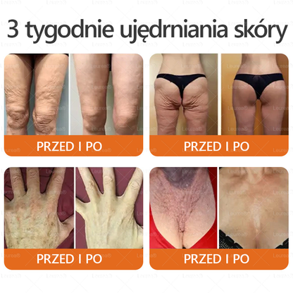 ✨Leurea® Jad Pszczeli Regeneracja Skóry Krem(👨‍⚕‍CE zatwierdzone)👍✅