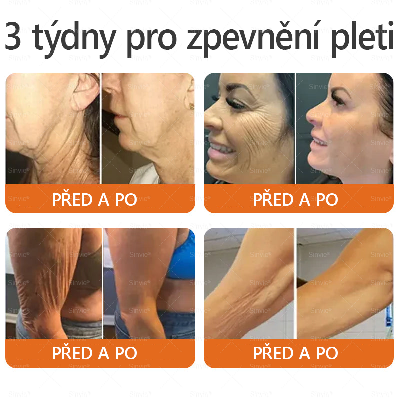 Doporučení dermatologa 🐝 ✨Sinvie® Krém na obnovu pleti s včelím jedem 🔥 Český vývoj, výroba a dodávka v České republice