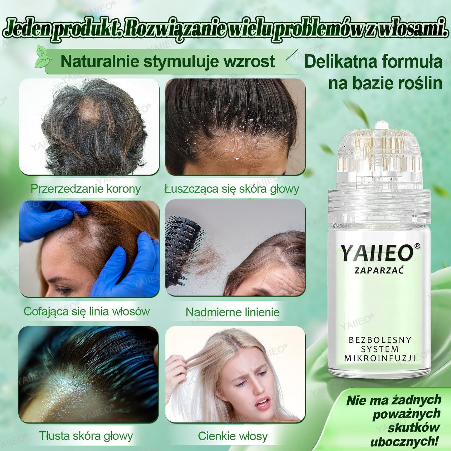 🌿 𝐘𝐀𝐈𝐈𝐄𝐎® Bezbolesny System Mikroinfuzji Głębokie blokowanie DHT, reaktywacja mieszków włosowych i widoczny wzrost włosów