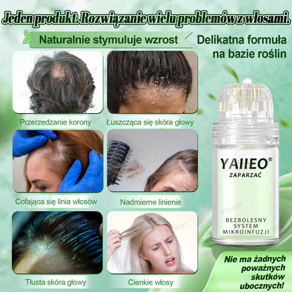 🌿 𝐘𝐀𝐈𝐈𝐄𝐎® Bezbolesny System Mikroinfuzji Głębokie blokowanie DHT, reaktywacja mieszków włosowych i widoczny wzrost włosów