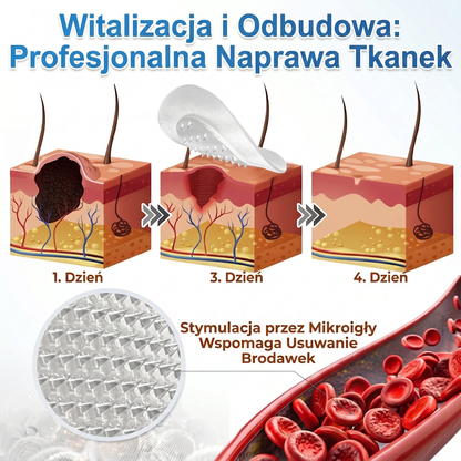 ✨PuraCure® 2-w-1 plaster mikroigłowy i hydrokoloidowy🍀 | Usuwa wypukłe znamiona, trądzik, płaskie brodawki i brodawki skórne | Pomaga poprawić zmarszczki, blizny i niedoskonałości | Niewidoczne plastry na twarz i ciało