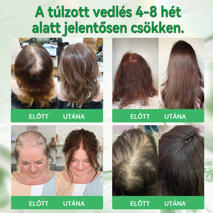 YAIIEO® 𝑭á𝒋𝒅𝒂𝒍𝒐𝒎𝒎𝒆𝒏𝒕𝒆𝒔 𝑴𝒊𝒌𝒓𝒐𝒊𝒏𝒇ú𝒛𝒊ó𝒔 𝑹𝒆𝒏𝒅𝒔𝒛𝒆𝒓