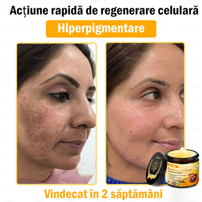 🧑‍⚕️Recomandat de dermatologi 🐝 Crema regeneratoare Sinvie® cu venin de albine 🔥 Ideală pentru riduri, pete pigmentare și piele lipsită de fermitate – 50 ml