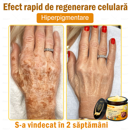 🧑‍⚕️Recomandat de dermatologi 🐝 Crema regeneratoare Sinvie® cu venin de albine 🔥 Ideală pentru riduri, pete pigmentare și piele lipsită de fermitate – 50 ml