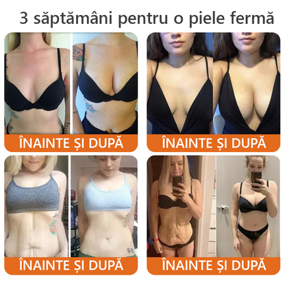 🧑‍⚕️Recomandat de dermatologi 🐝 Crema regeneratoare Sinvie® cu venin de albine 🔥 Ideală pentru riduri, pete pigmentare și piele lipsită de fermitate – 50 ml