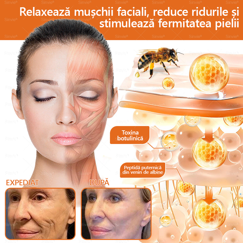 🧑‍⚕️Recomandat de dermatologi 🐝 Crema regeneratoare Sinvie® cu venin de albine 🔥 Ideală pentru riduri, pete pigmentare și piele lipsită de fermitate – 50 ml