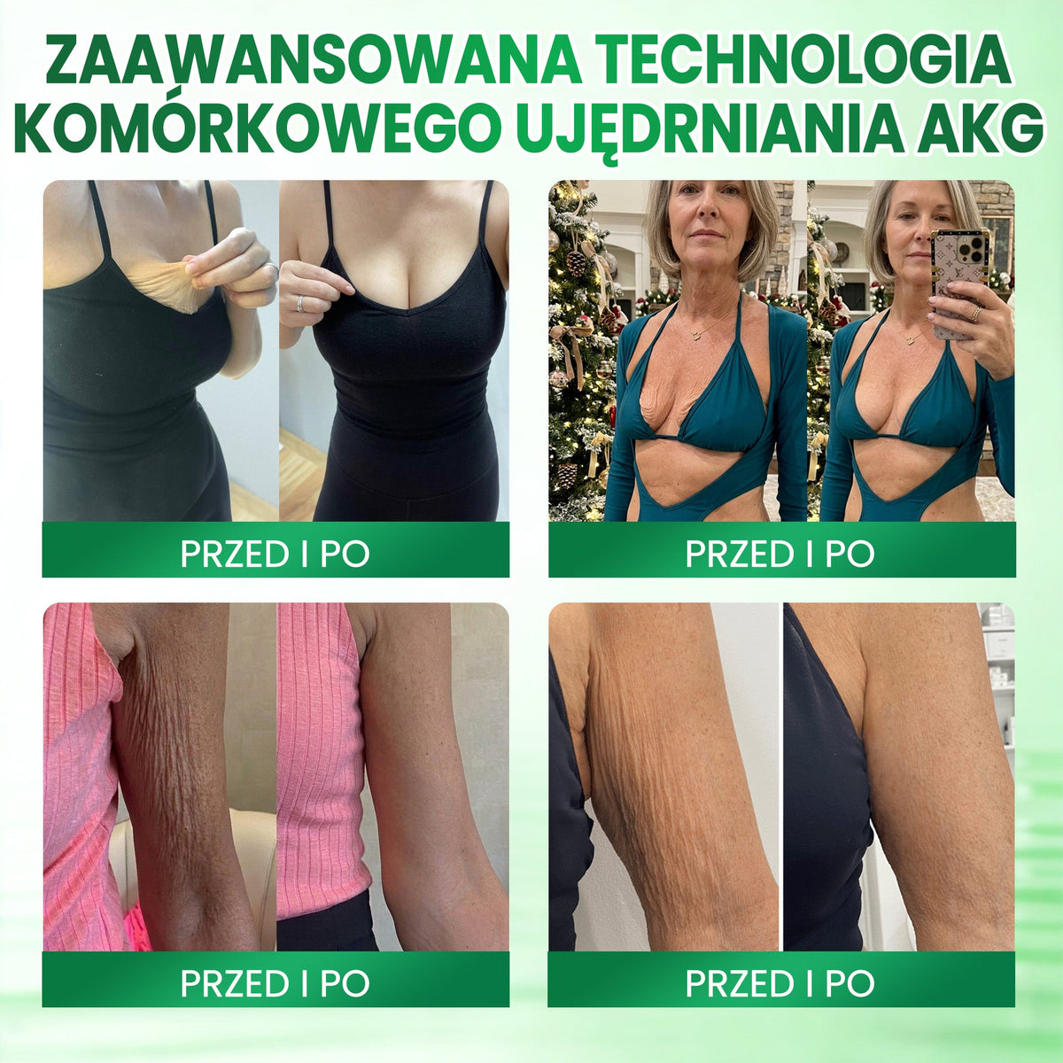 Medistart® AKG – Ujędrniająca pielęgnacja skóry przeciw oznakom starzenia 🌲