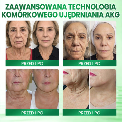 Medistart® AKG – Ujędrniająca pielęgnacja skóry przeciw oznakom starzenia 🌲