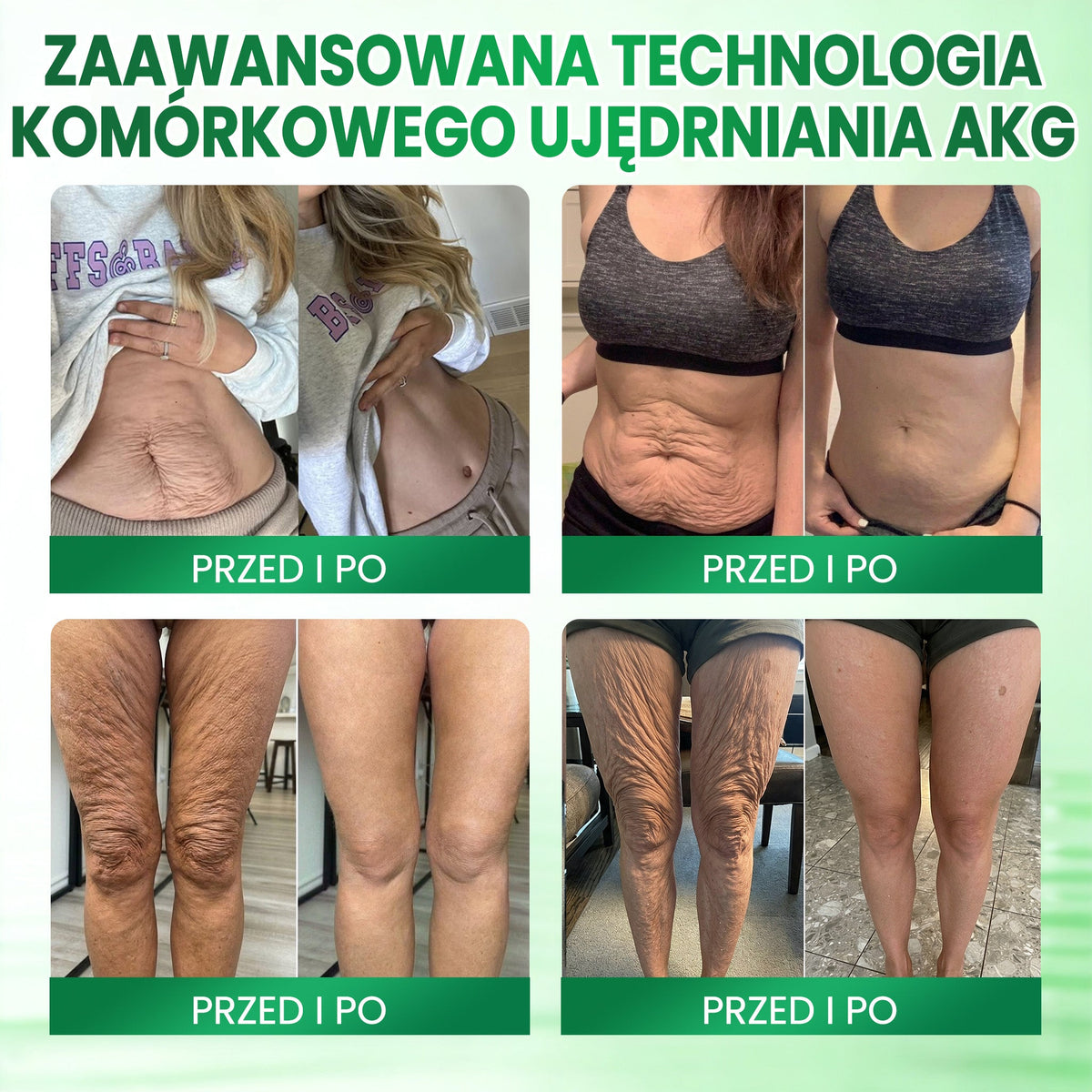 Medistart® AKG – Ujędrniająca pielęgnacja skóry przeciw oznakom starzenia 🌲