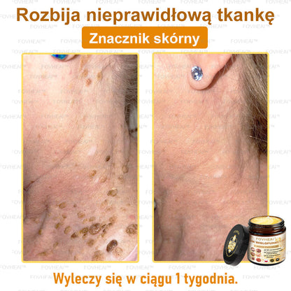 💎🏆FOVHEAl™ Krem wielofunkcyjny z jadem pszczelim - Polecane przez dermatologów – Odpowiednie dla każdego wieku