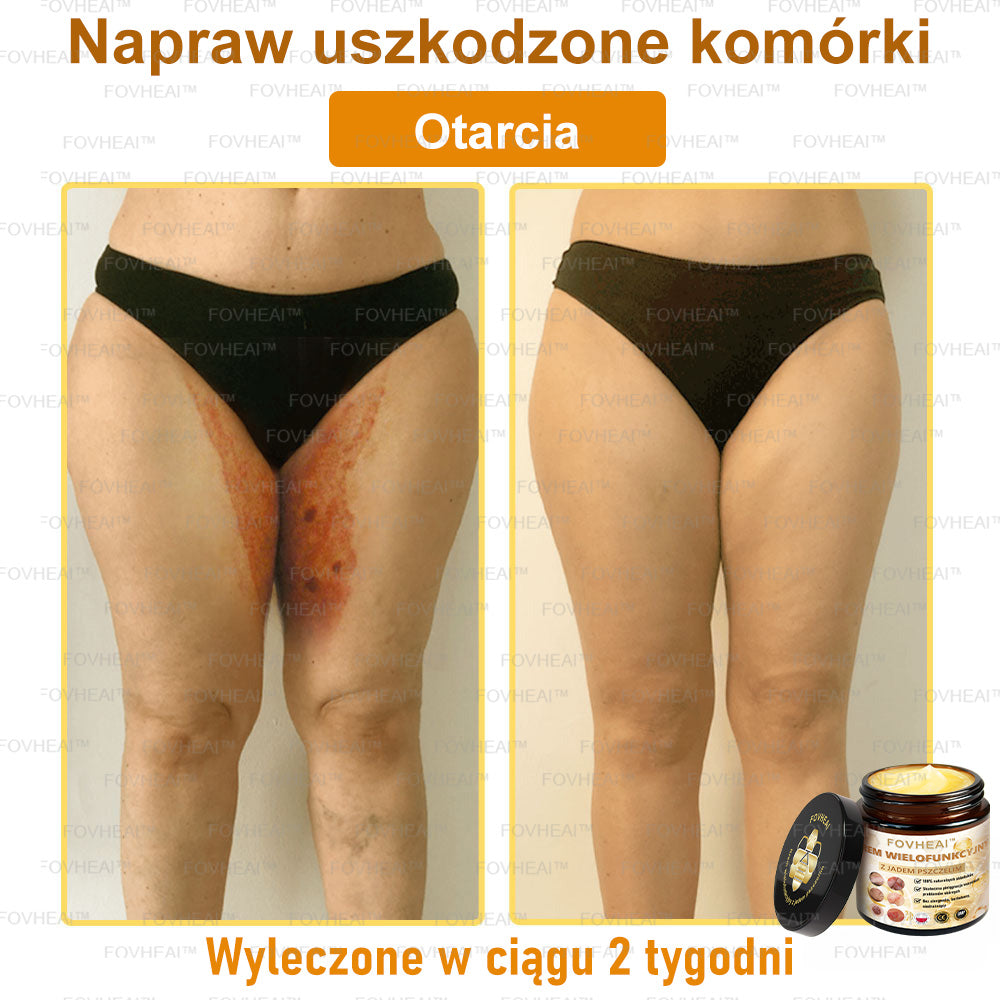💎🏆FOVHEAl™ Krem wielofunkcyjny z jadem pszczelim - Polecane przez dermatologów – Odpowiednie dla każdego wieku