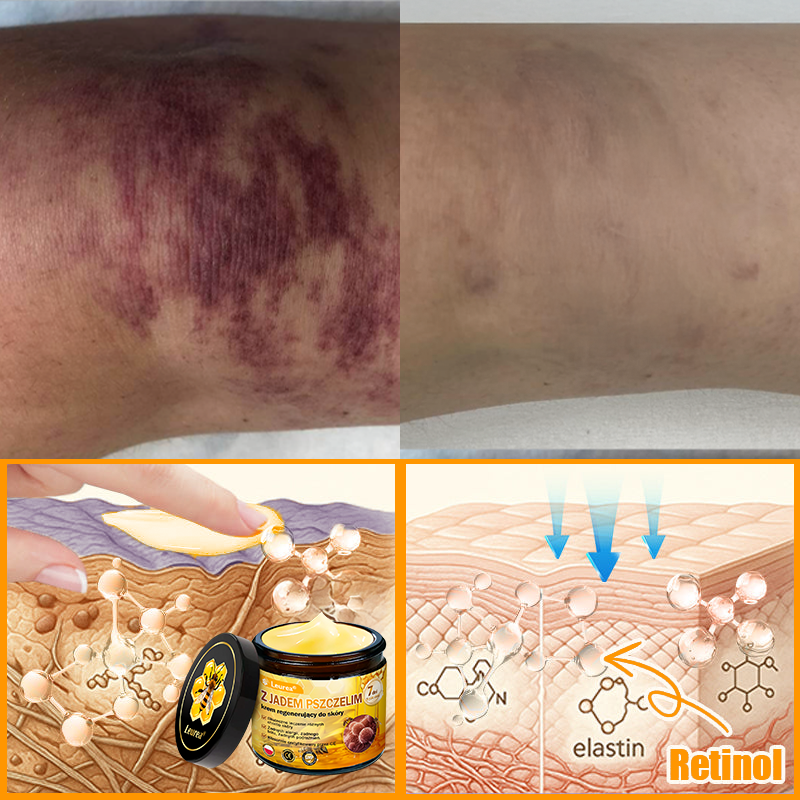 🔥 Leurea® Krem z Jadem Pszczelim do Regeneracji Skóry 🔥 Naturalna regeneracja, wygładzenie zmarszczek, poprawa kondycji skóry oraz redukcja plamicy starczej (purpury) – 50 ml