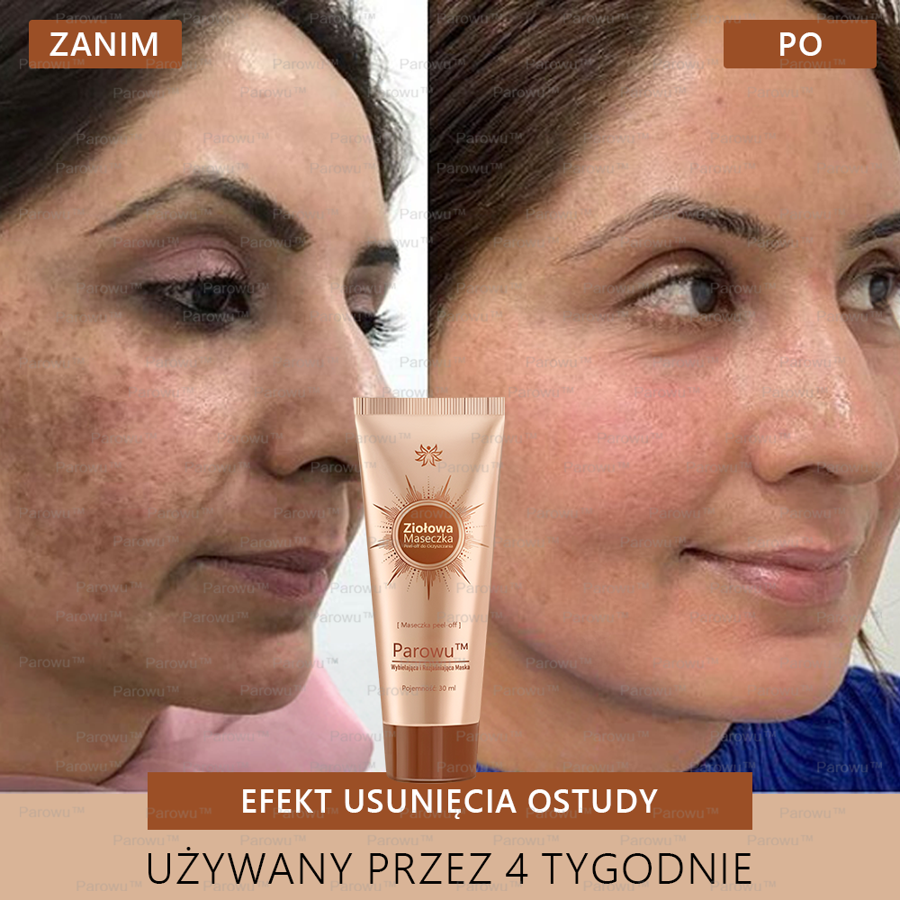 🔥 Parowu™ Wybielająca i Rozjaśniająca Maska - Naturalne składniki trwale usuwają plamy, piegi i przebarwienia🔥🔥🔥