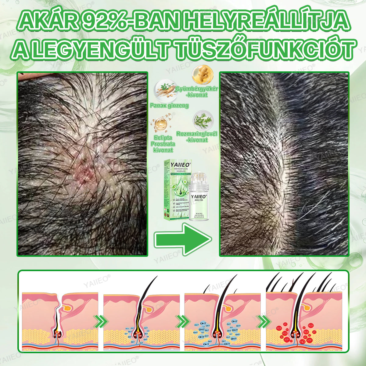 YAIIEO® 𝑭á𝒋𝒅𝒂𝒍𝒐𝒎𝒎𝒆𝒏𝒕𝒆𝒔 𝑴𝒊𝒌𝒓𝒐𝒊𝒏𝒇ú𝒛𝒊ó𝒔 𝑹𝒆𝒏𝒅𝒔𝒛𝒆𝒓