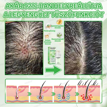 YAIIEO® 𝑭á𝒋𝒅𝒂𝒍𝒐𝒎𝒎𝒆𝒏𝒕𝒆𝒔 𝑴𝒊𝒌𝒓𝒐𝒊𝒏𝒇ú𝒛𝒊ó𝒔 𝑹𝒆𝒏𝒅𝒔𝒛𝒆𝒓