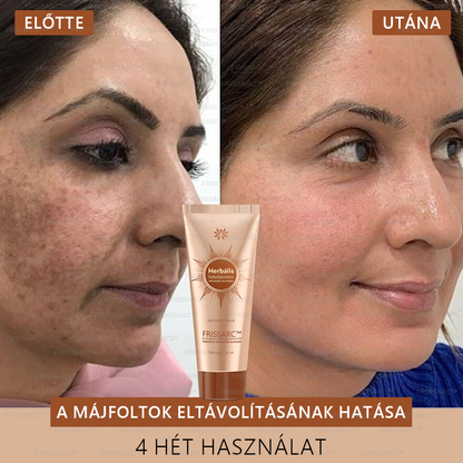 𝐅𝐑𝐈𝐒𝐒𝐀𝐑𝐂™ Fehérítő És Folteltávolító Arcmaszk | Természetes összetevők tartósan eltüntetik a foltokat, szeplőket és napfoltokat🔥
