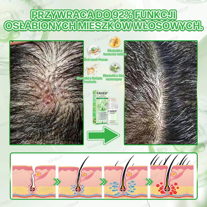 🌿 𝐘𝐀𝐈𝐈𝐄𝐎® Bezbolesny System Mikroinfuzji Głębokie blokowanie DHT, reaktywacja mieszków włosowych i widoczny wzrost włosów