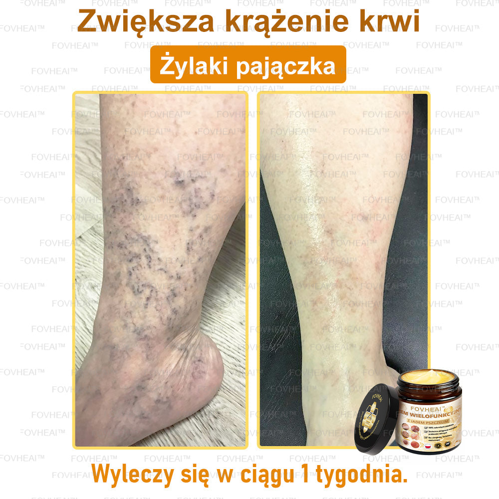 💎🏆FOVHEAl™ Krem wielofunkcyjny z jadem pszczelim - Polecane przez dermatologów – Odpowiednie dla każdego wieku