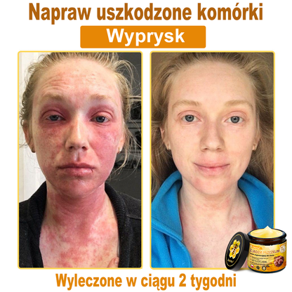 ✨Leurea® Jad Pszczeli Regeneracja Skóry Krem(👨‍⚕‍CE zatwierdzone)👍✅