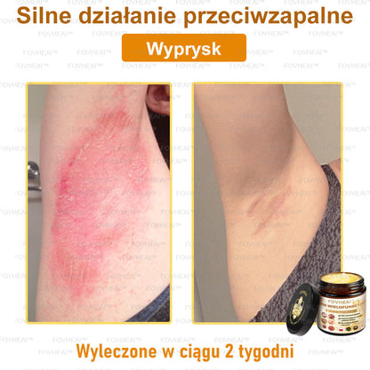 💎🏆FOVHEAl™ Krem wielofunkcyjny z jadem pszczelim - Polecane przez dermatologów – Odpowiednie dla każdego wieku