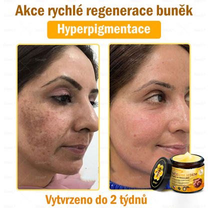 Doporučení dermatologa 🐝 ✨Sinvie® Krém na obnovu pleti s včelím jedem 🔥 Český vývoj, výroba a dodávka v České republice