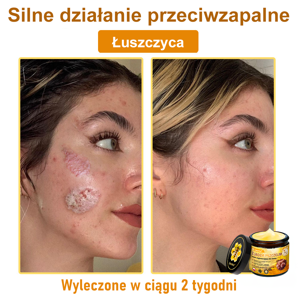 ✨Leurea® Jad Pszczeli Regeneracja Skóry Krem(👨‍⚕‍CE zatwierdzone)👍✅