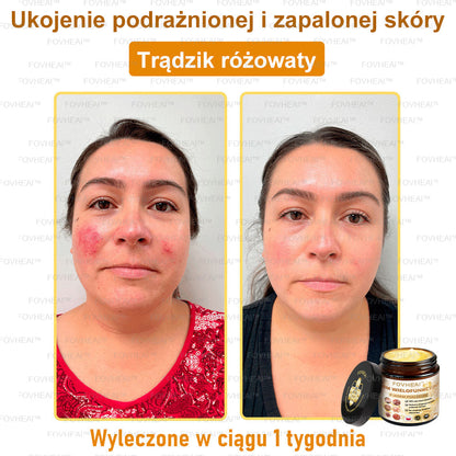 💎🏆FOVHEAl™ Krem wielofunkcyjny z jadem pszczelim - Polecane przez dermatologów – Odpowiednie dla każdego wieku