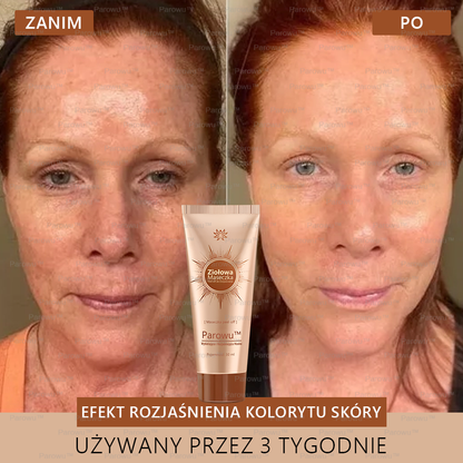 Parowu™ Wybielająca i Rozjaśniająca Maska - Naturalne składniki trwale usuwają plamy, piegi i przebarwienia🔥🔥🔥