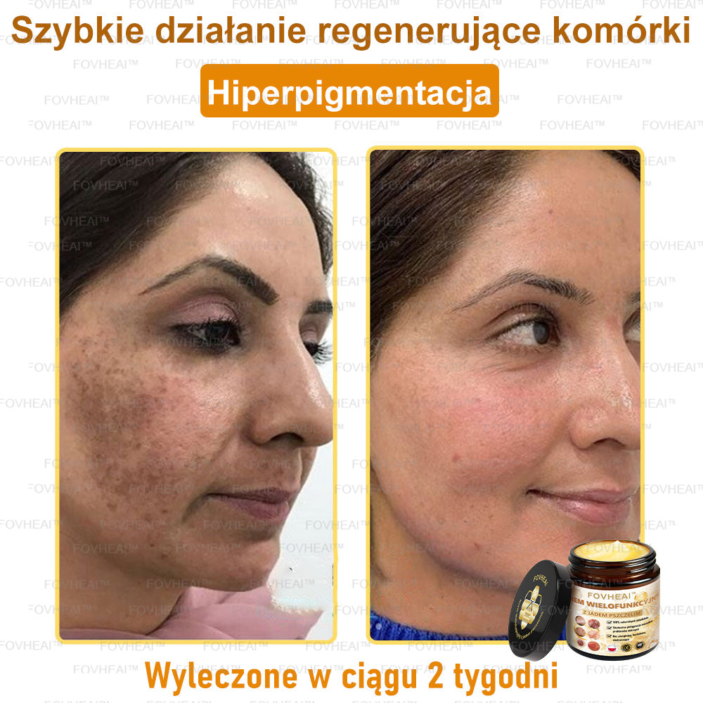 💎🏆FOVHEAl™ Krem wielofunkcyjny z jadem pszczelim - Polecane przez dermatologów – Odpowiednie dla każdego wieku