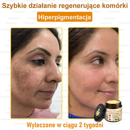 💎🏆FOVHEAl™ Krem wielofunkcyjny z jadem pszczelim - Polecane przez dermatologów – Odpowiednie dla każdego wieku