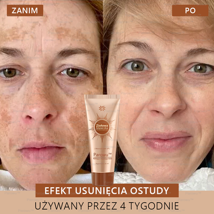 Parowu™ Wybielająca i Rozjaśniająca Maska - Naturalne składniki trwale usuwają plamy, piegi i przebarwienia🔥🔥🔥