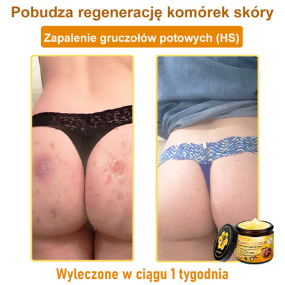 ✨Leurea® Jad Pszczeli Regeneracja Skóry Krem(👨‍⚕‍CE zatwierdzone)👍✅