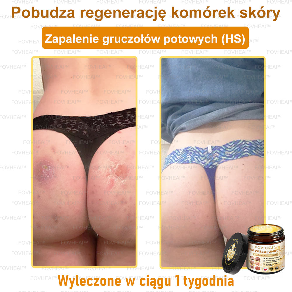 💎🏆FOVHEAl™ Krem wielofunkcyjny z jadem pszczelim - Polecane przez dermatologów – Odpowiednie dla każdego wieku
