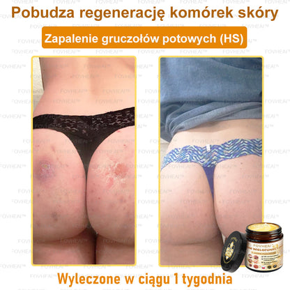 💎🏆FOVHEAl™ Krem wielofunkcyjny z jadem pszczelim - Polecane przez dermatologów – Odpowiednie dla każdego wieku