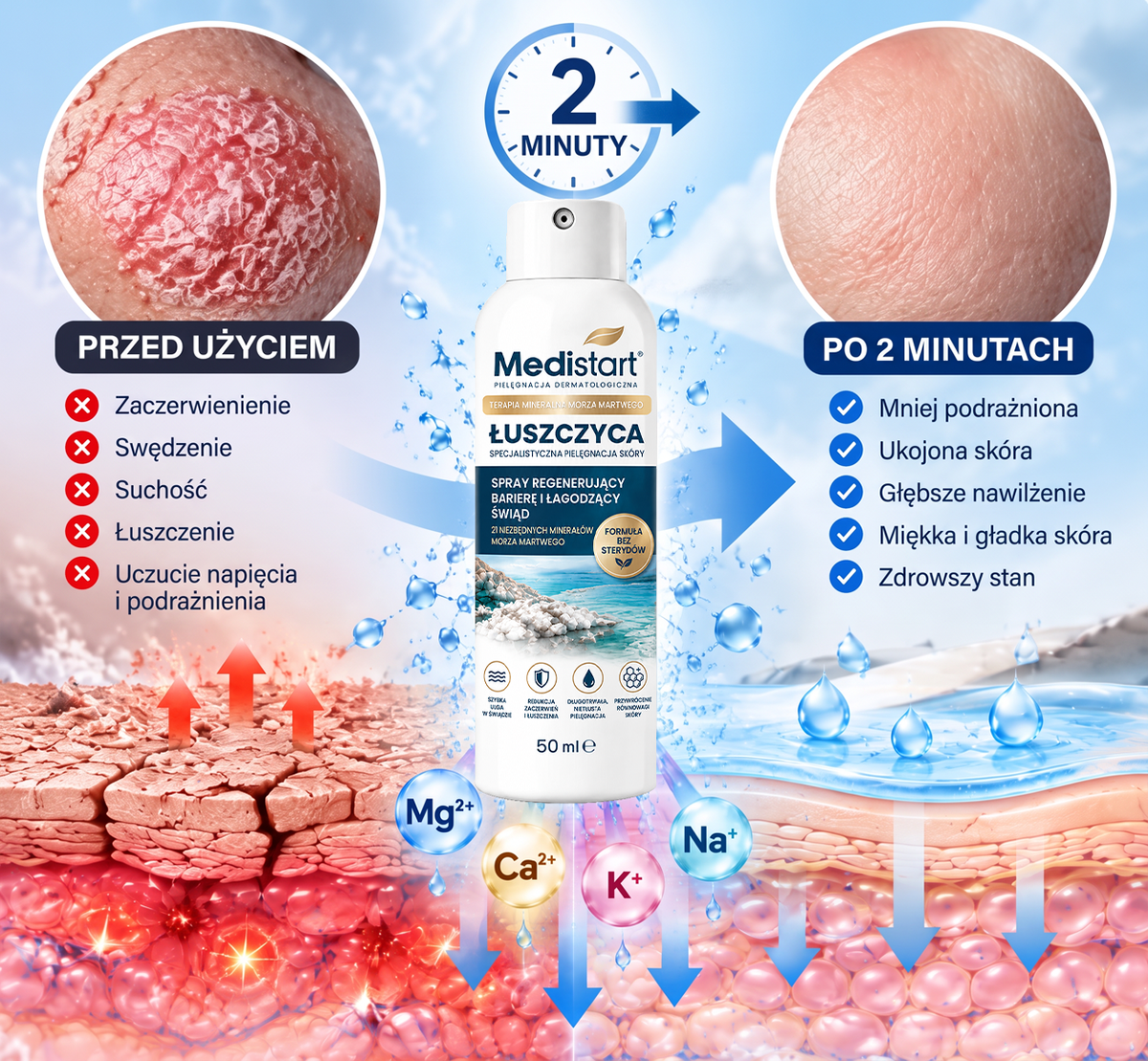 Medistart® Specjalistyczna Pielęgnacja Skóry z Łuszczycą