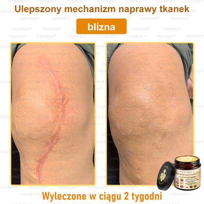 💎🏆FOVHEAl™ Krem wielofunkcyjny z jadem pszczelim - Polecane przez dermatologów – Odpowiednie dla każdego wieku