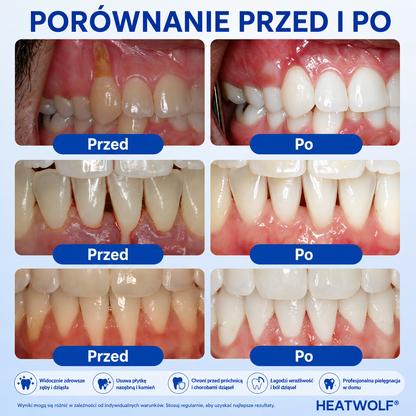 🇵🇱👨‍⚕️✅🦷PuraCure® EMD Intensywny Żel do Pielęgnacji Cofających się Dziąseł 🌿