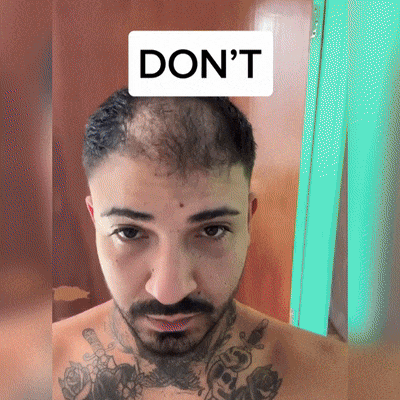 🌿 𝐘𝐀𝐈𝐈𝐄𝐎® Bezbolesny System Mikroinfuzji Głębokie blokowanie DHT, reaktywacja mieszków włosowych i widoczny wzrost włosów